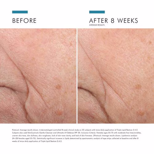 Triple Lipid Restore 2:4:2- 48ml - Image 2
