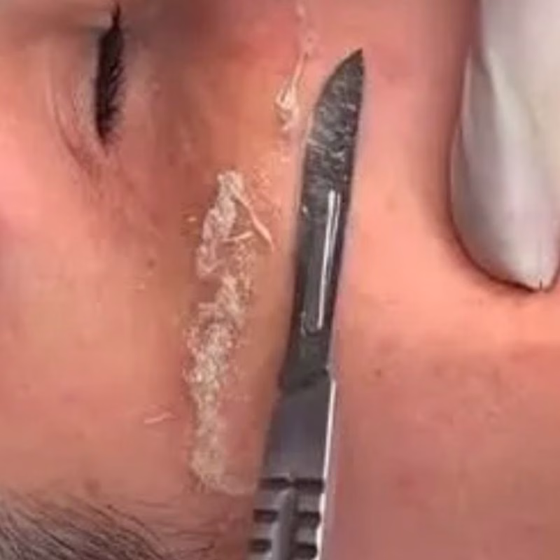 Dermaplaning-Facial-Tools-in-Huntington-NY