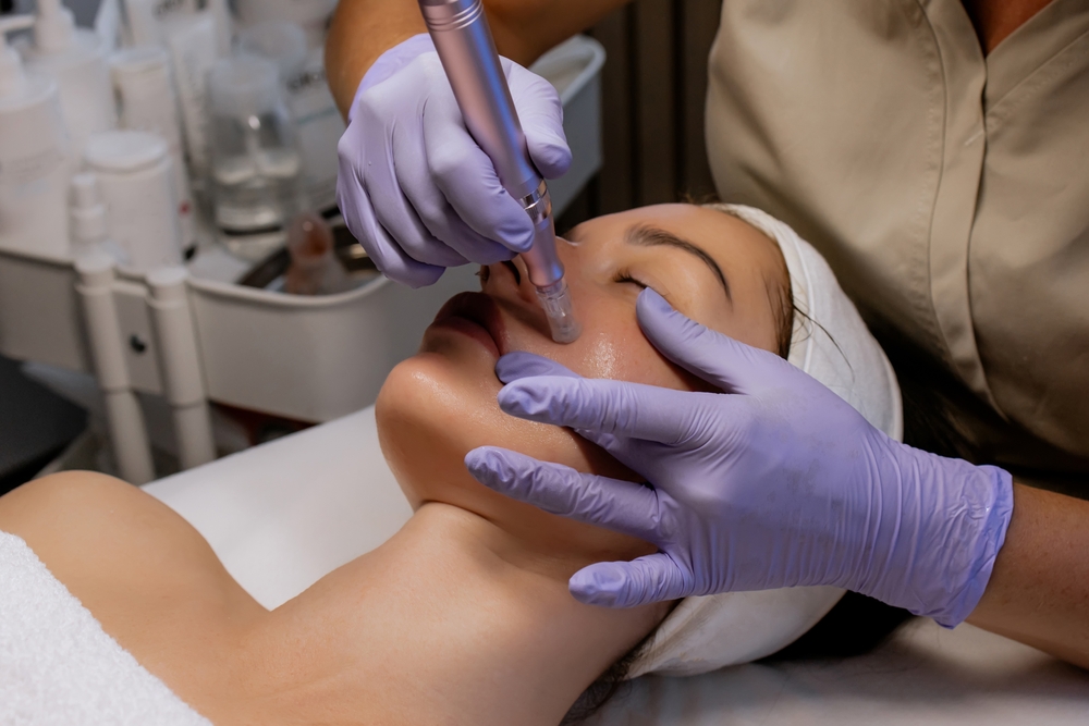 Microneedlings