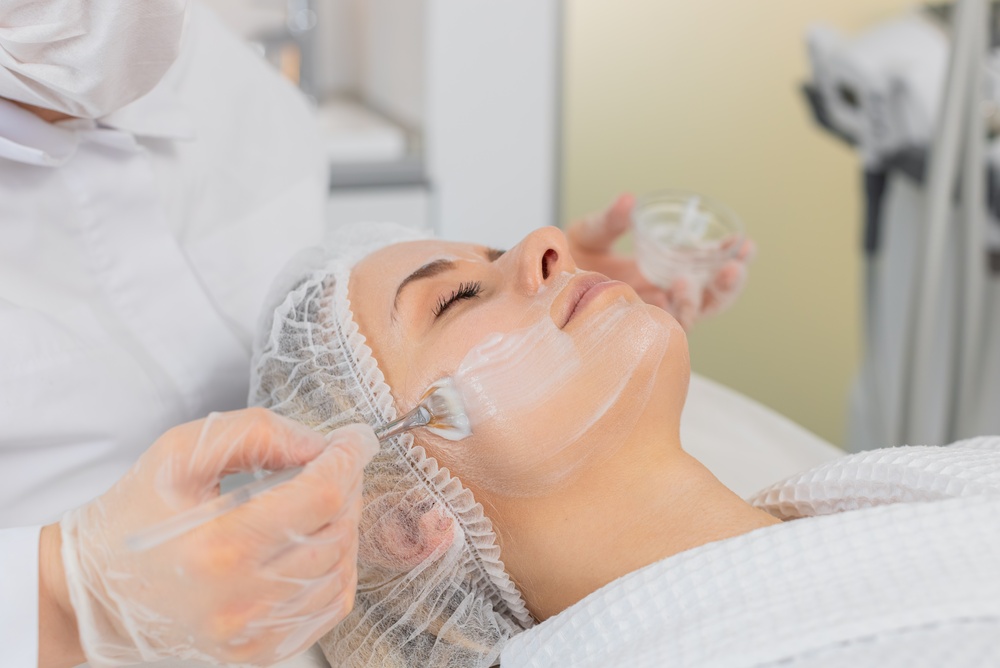 acne peel