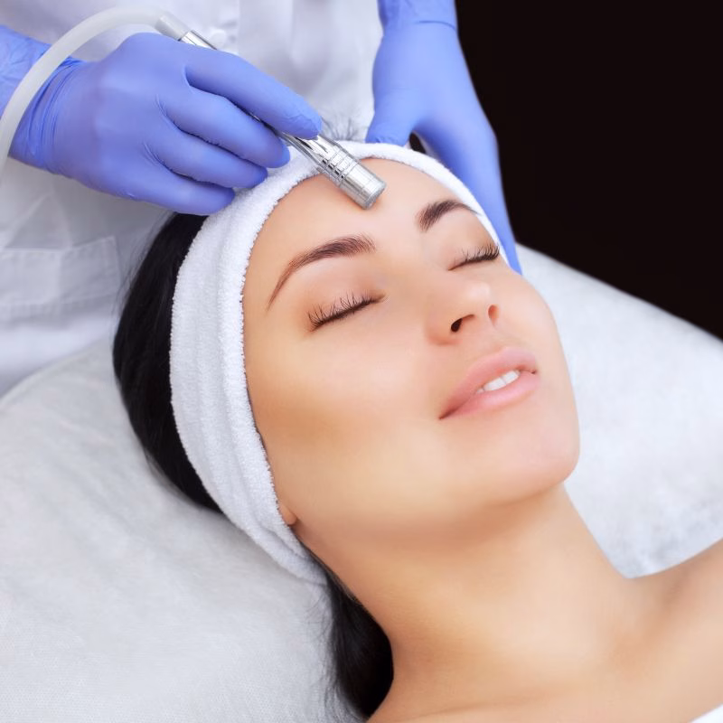 Before-and-After-Microdermabrasion-Facial-in-Huntington-NY