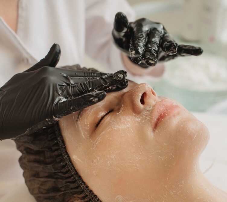 Derma Peel