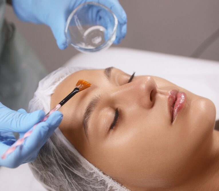 Derma Peels