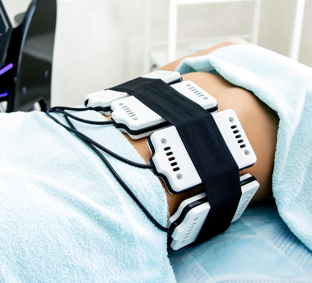 Laser Lipolysis