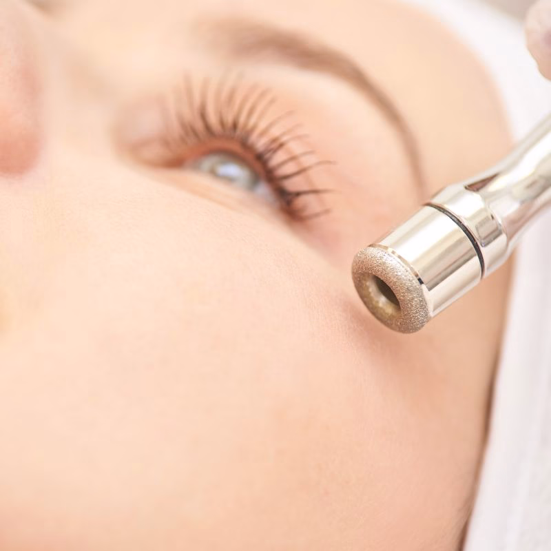 Microdermabrasion-Facial-Treatment-in-Huntington-NY