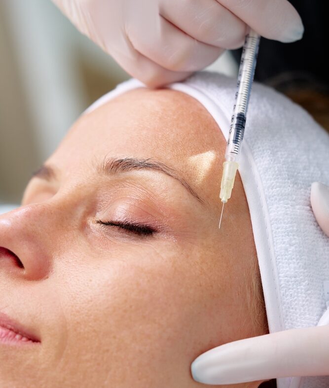 Radiesse Dermal Filler