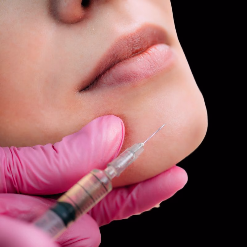 Safe Chin filler by Lysty Aesthetics near Huntington