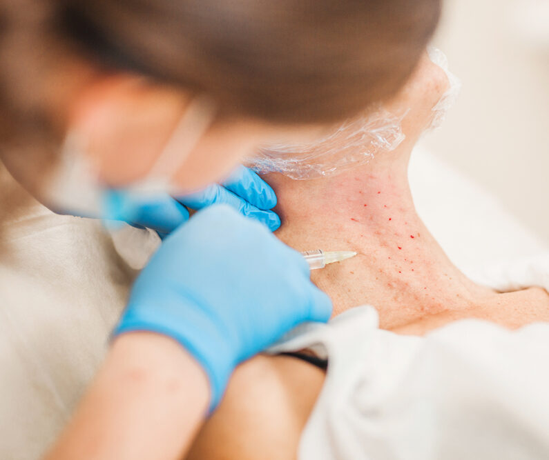 botox for neck