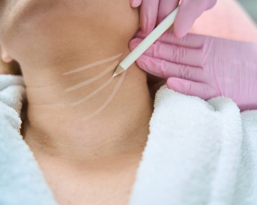neck botox