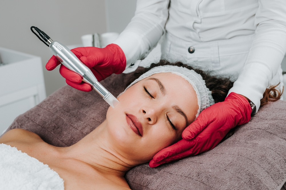 prp microneedling