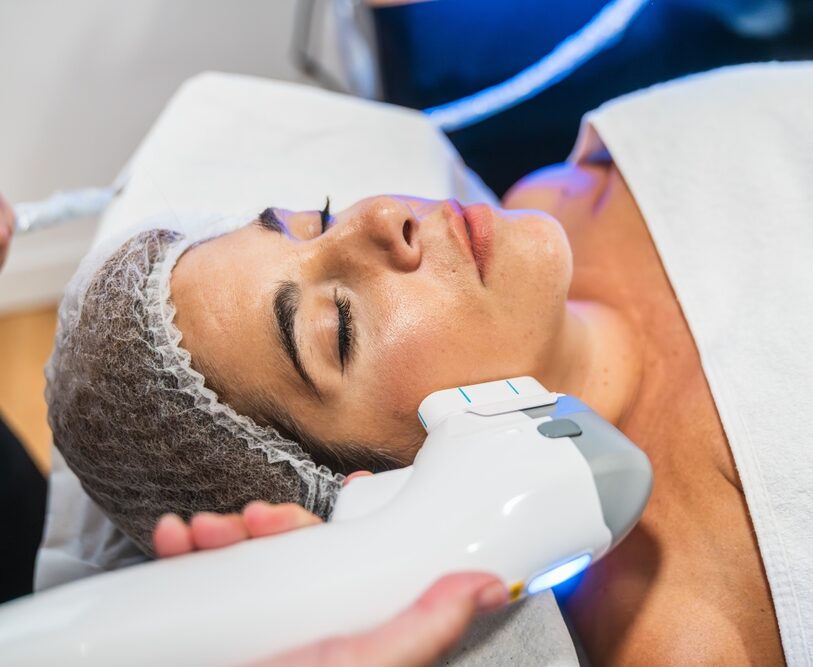 ultrasound facials